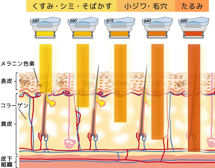 5種類の波長フィルター