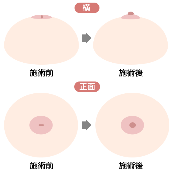 SPバナー