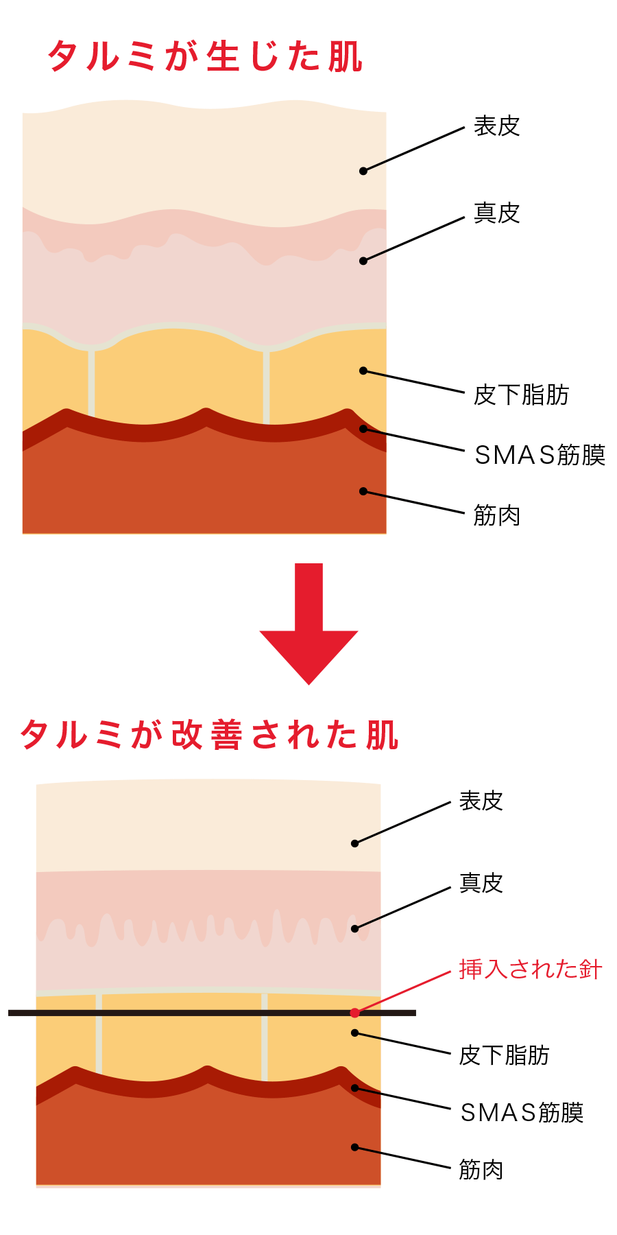 SPバナー